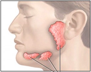 Viêm tuyến nước bọt đơn thuần