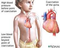 Việt Nam có lượng trẻ em mắc bệnh tim bẩm sinh mỗi năm đạt mức báo động
